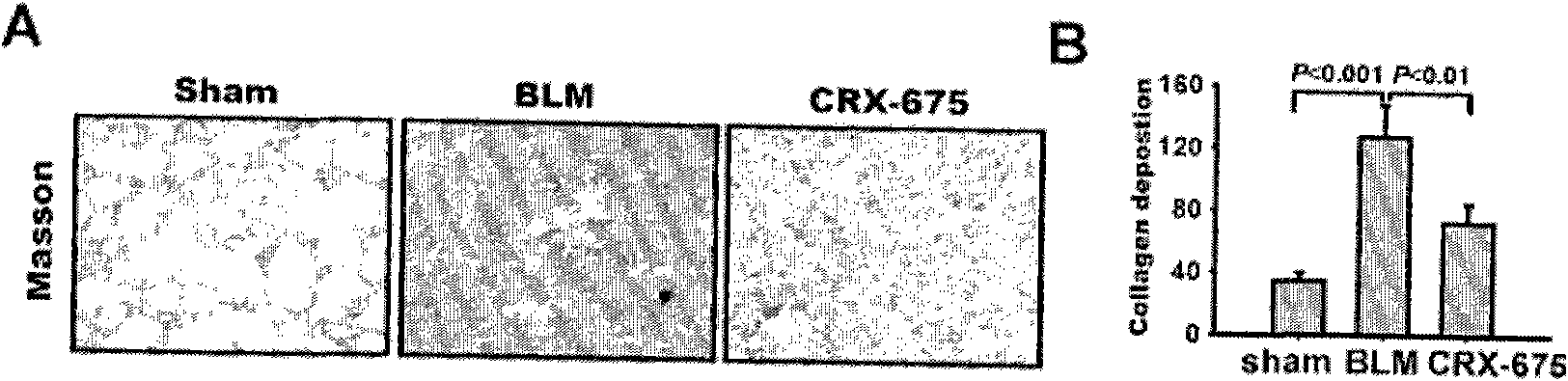 Application of stimulating agent CRX-675 of Toll-like receiver in resisting pulmonary fibrosis