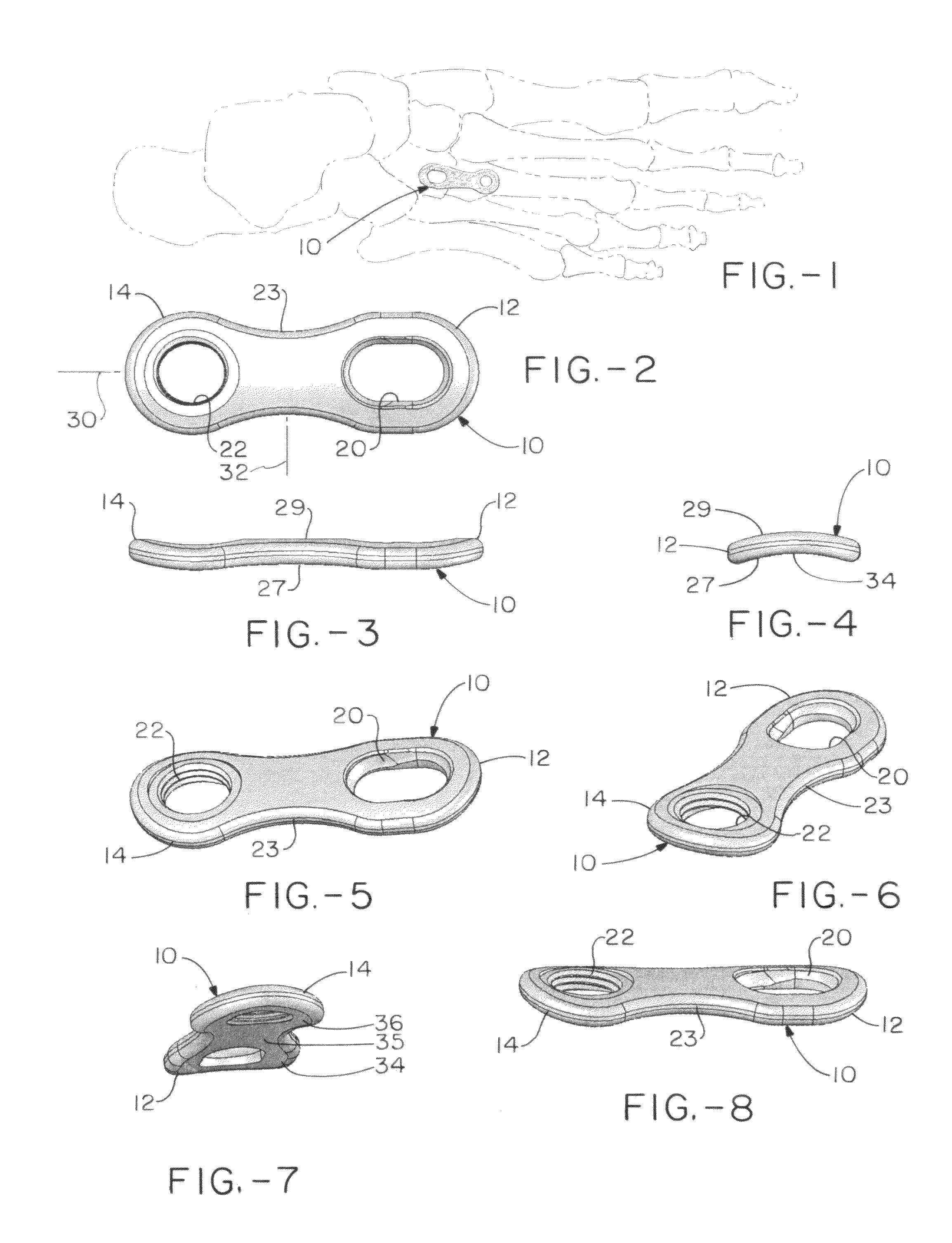 Orthopedic plate for use on a single ray in the midfoot