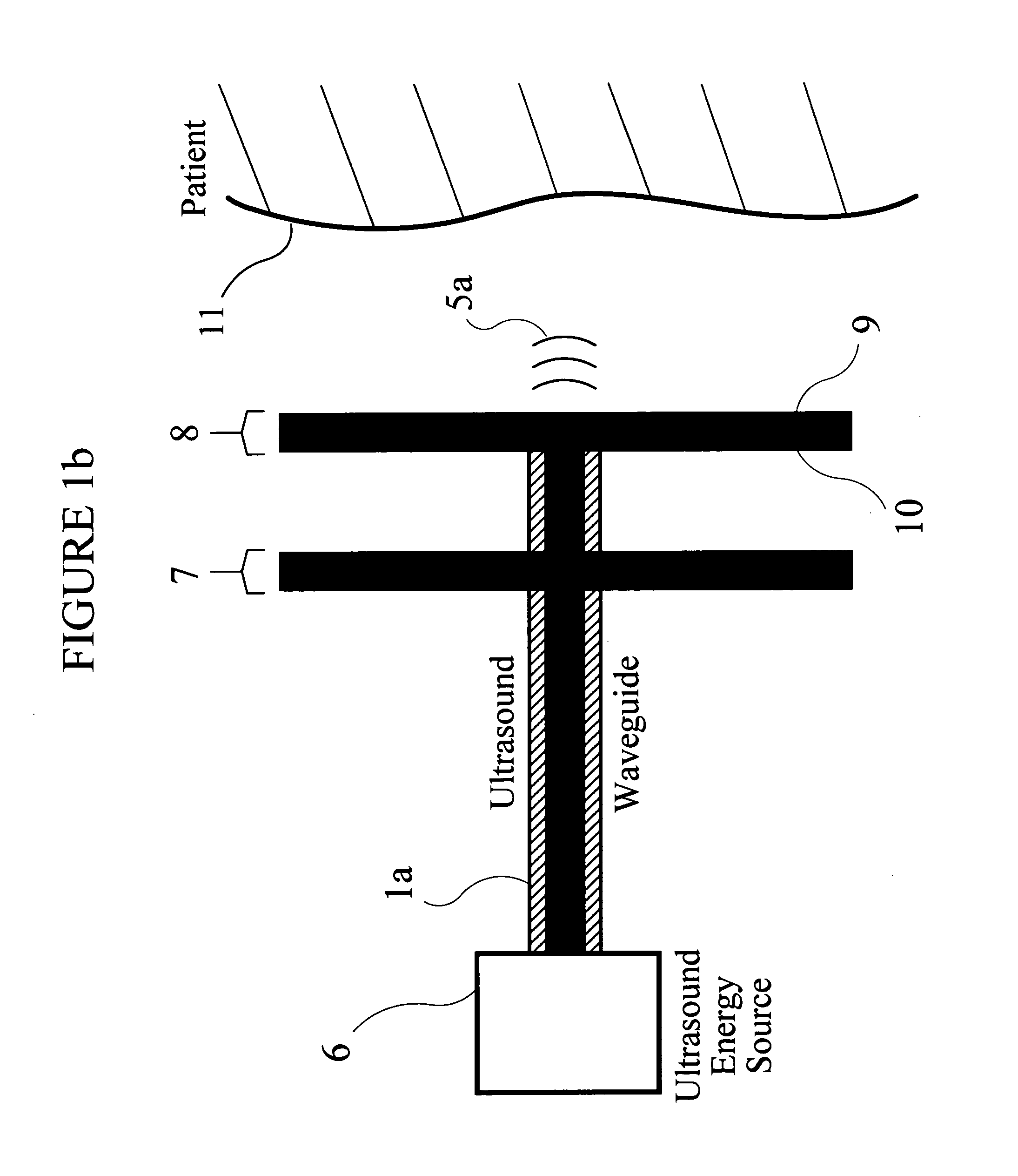 Ultrasonic apparatus and method for treating obesity or fat-deposits or for delivering cosmetic or other bodily therapy