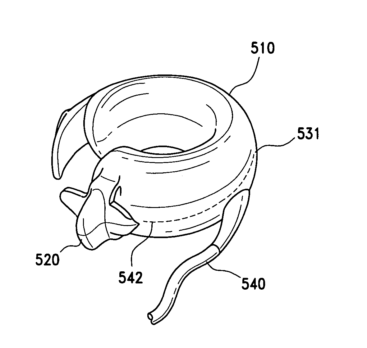 Precurved gastric band