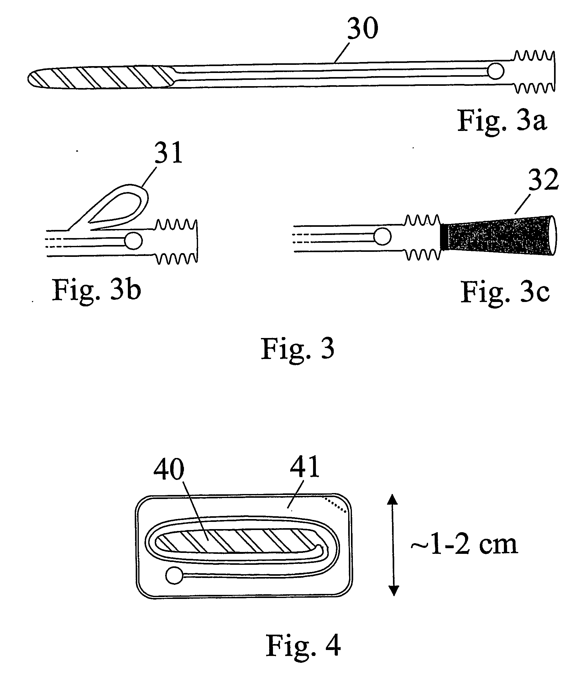 Device for opening a human bladder