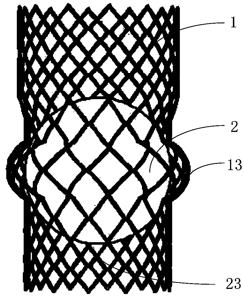 Liquid injection type cage ball aortic valve support system