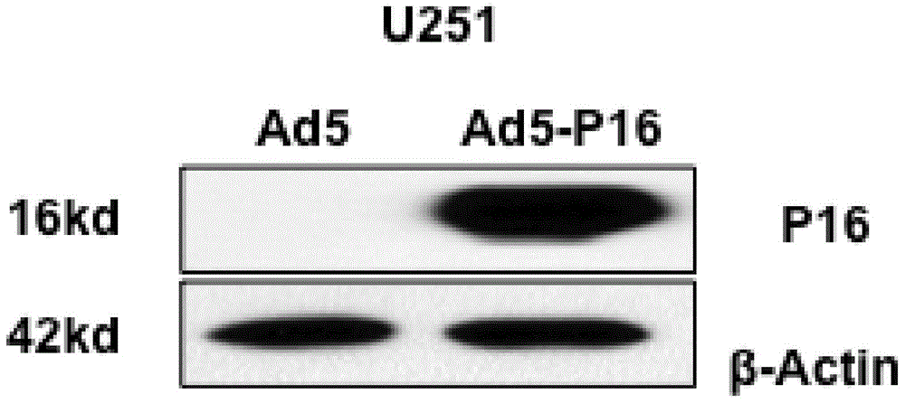 Recombinant oncolytic adenovirus Ad5-P16 with tumor tissue targeting and cancer suppressor gene repairing properties and application thereof