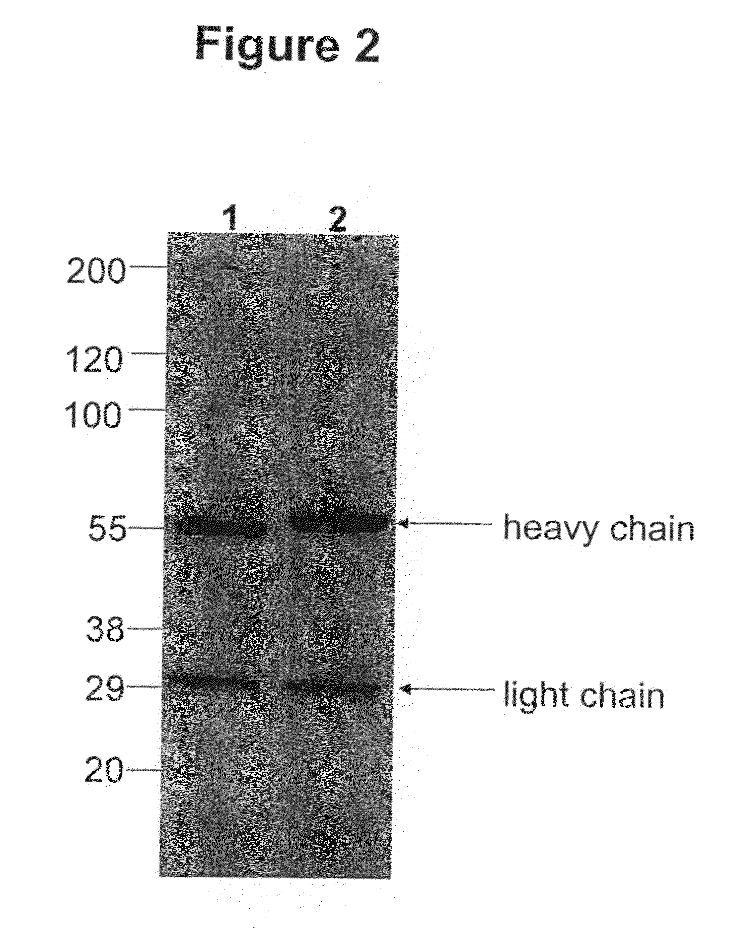 Immunoglobulins comprising predominantly a Man3GlcNAc2 glycoform