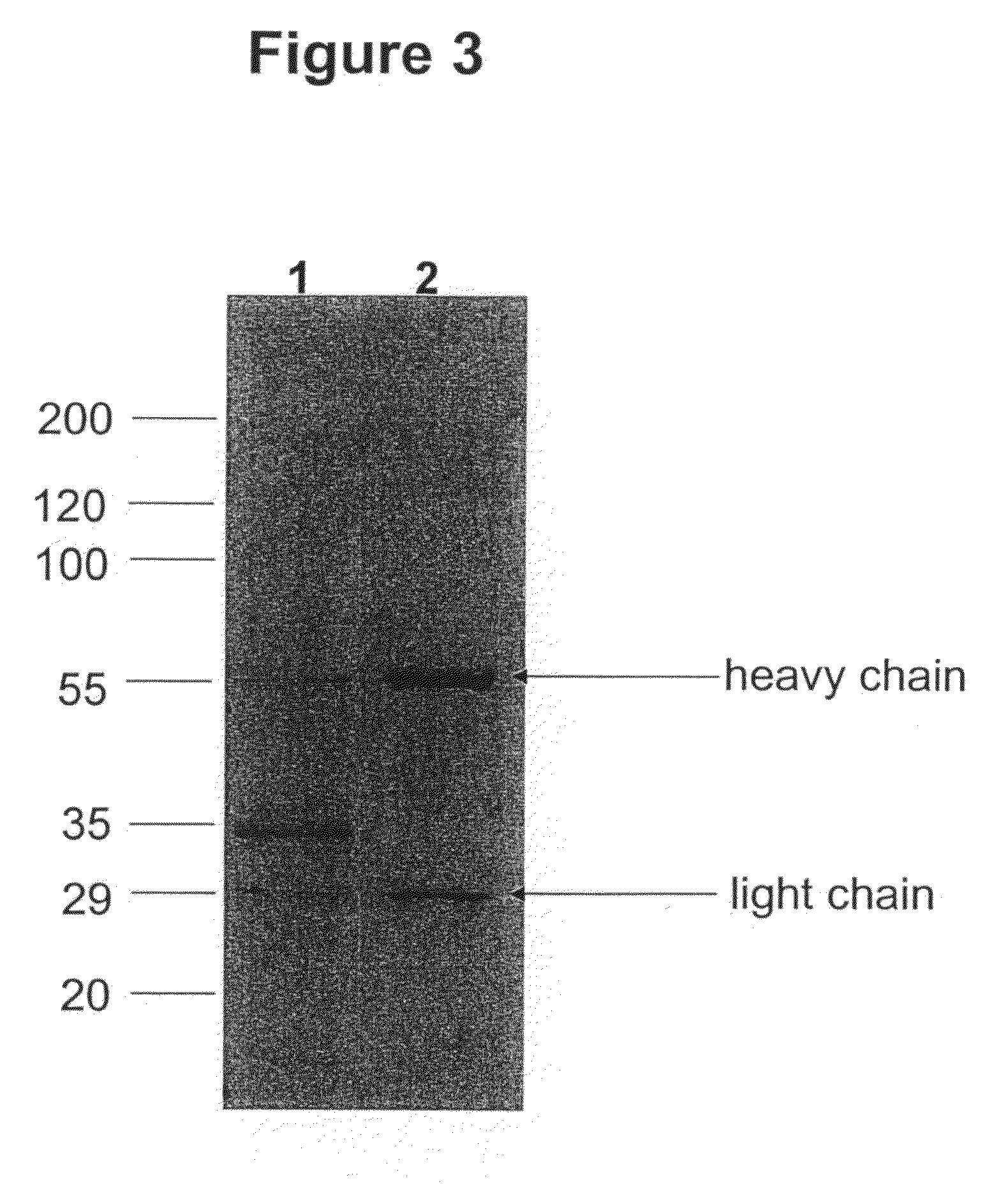 Immunoglobulins comprising predominantly a Man3GlcNAc2 glycoform