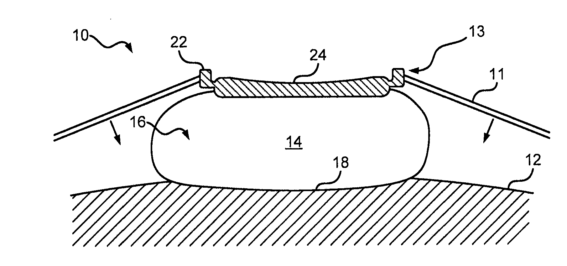 System and Method for Fetal Heart Monitoring Using Ultrasound