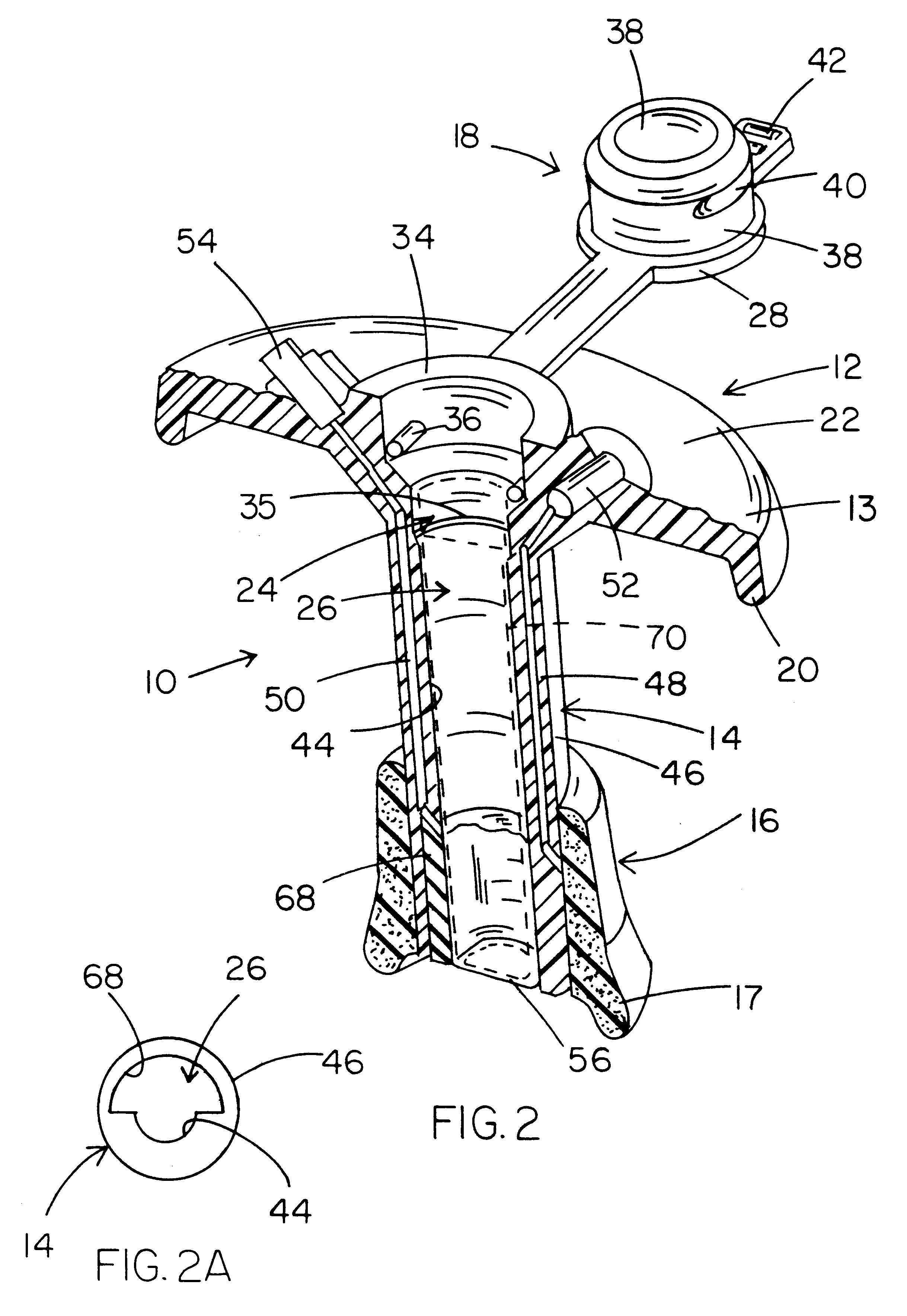 Continent ostomy port