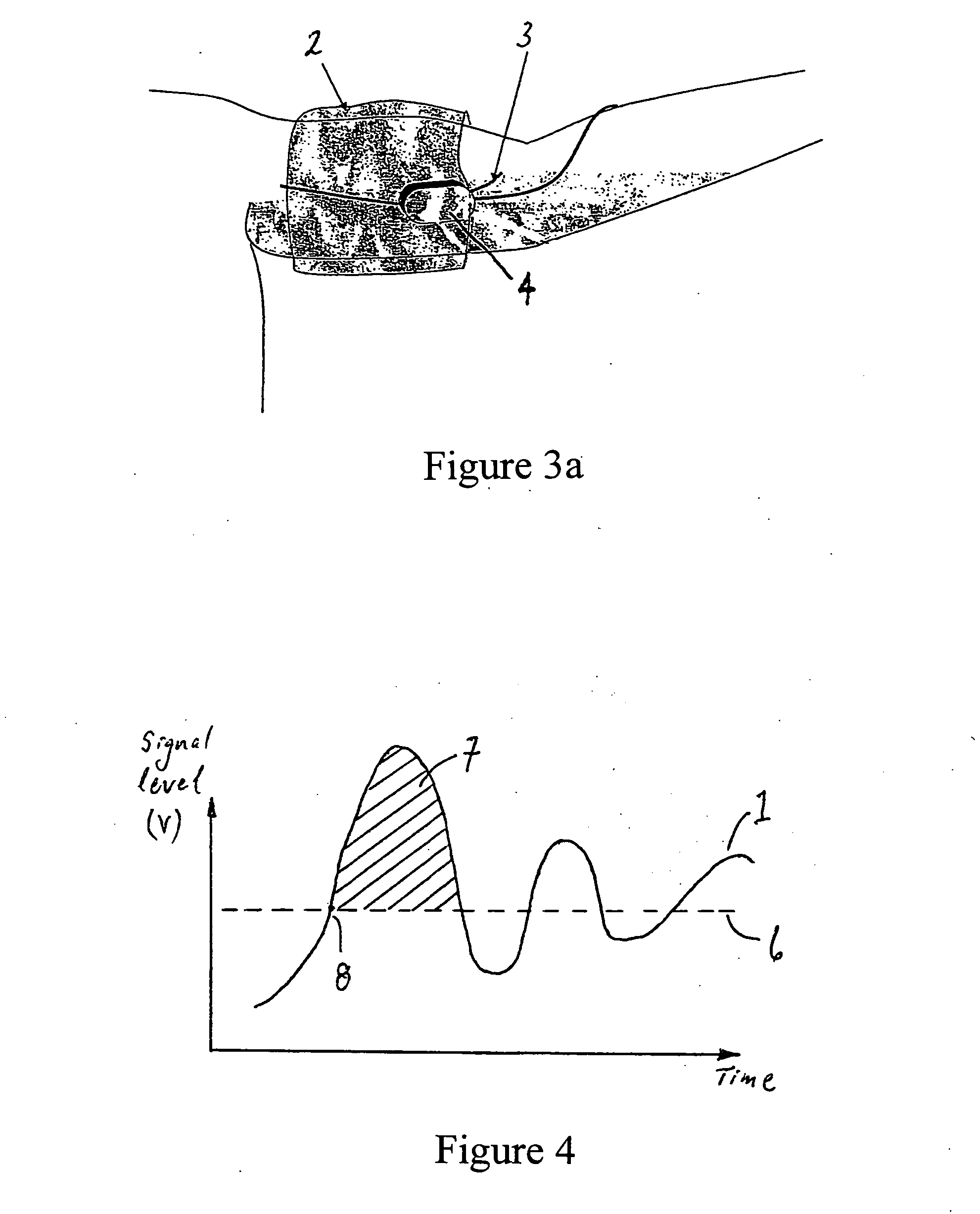 System and method for non-invasive cardiovascular assessment from supra-systolic signals obtained with a wideband external pulse transducer in a blood pressure cuff