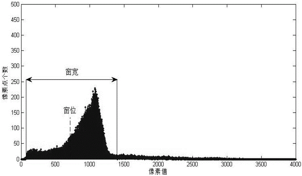 ROI (Region of Interest) window width and position adjusting method of medical image