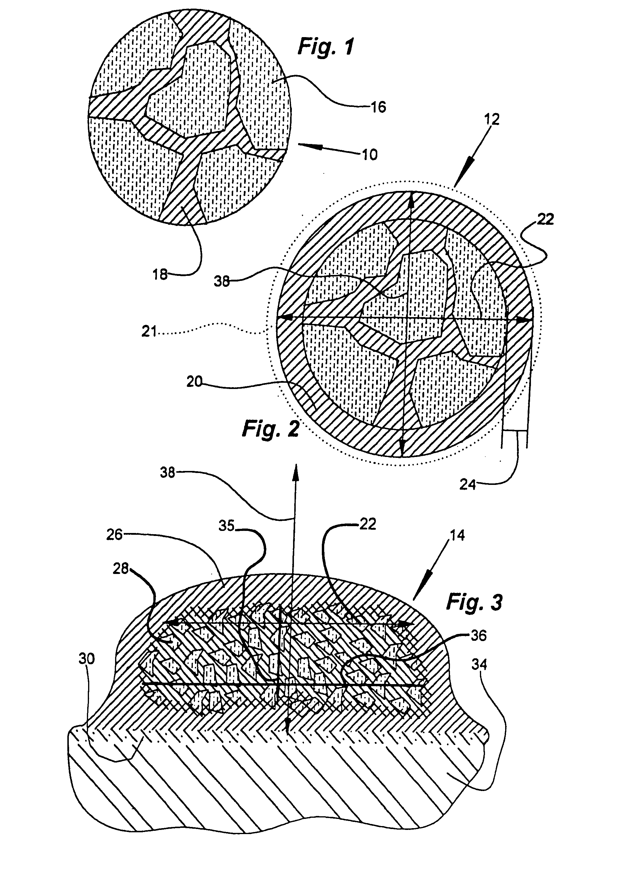 Heterogeneous composite bodies with isolated lenticular shapped cermet regions