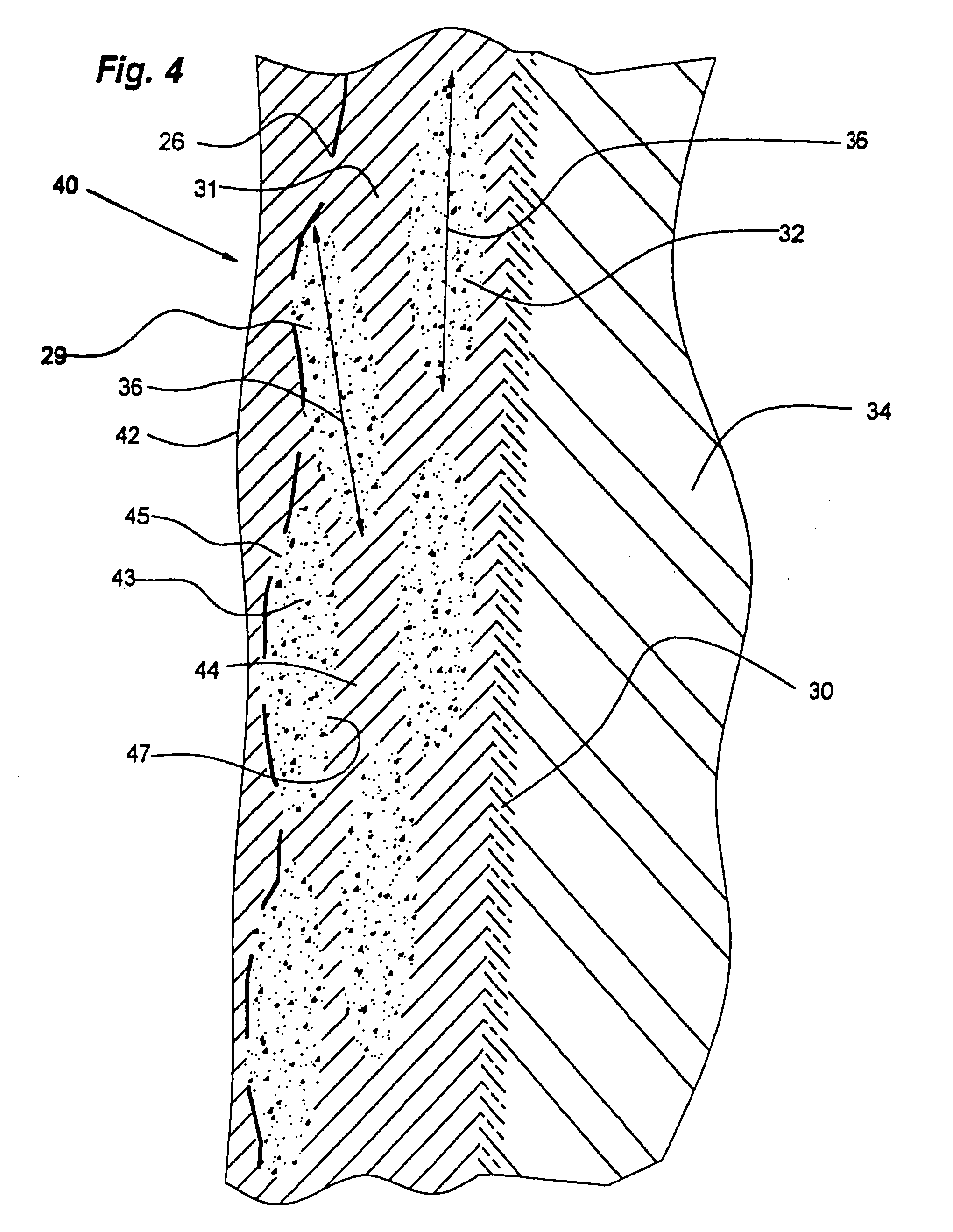 Heterogeneous composite bodies with isolated lenticular shapped cermet regions