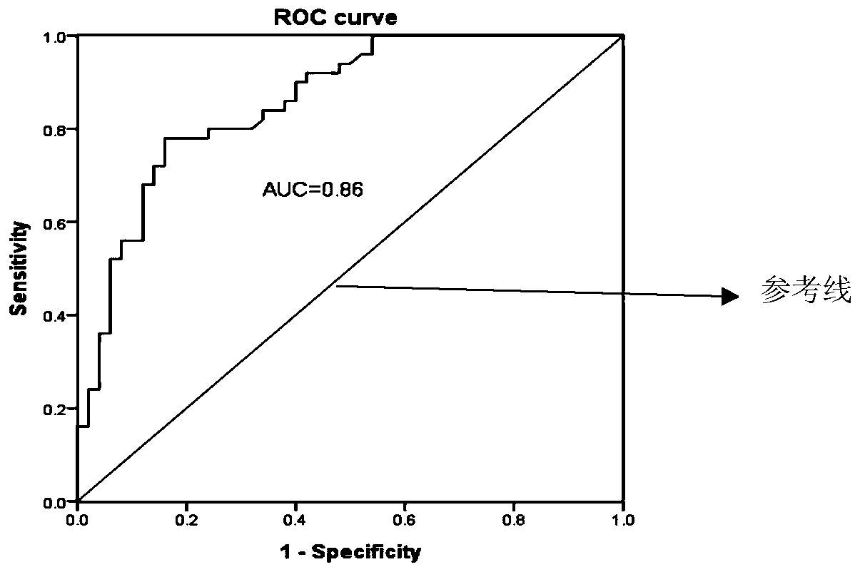 MiR-145-5P molecular marker for detecting type 2 diabetes mellitus, and amplification primers and application of miR-145-5P molecular marker