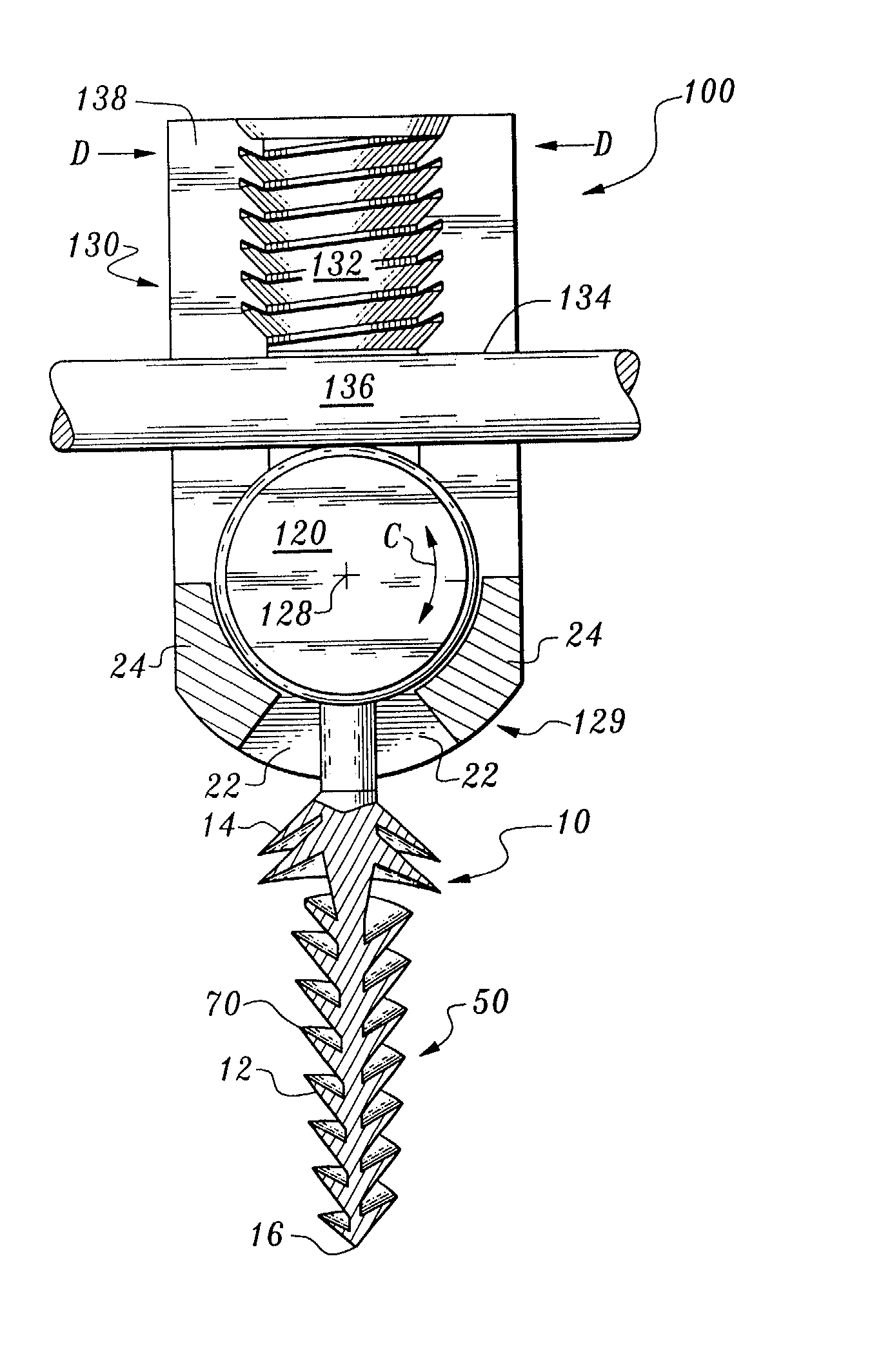 Orthopedic stabilization device and method