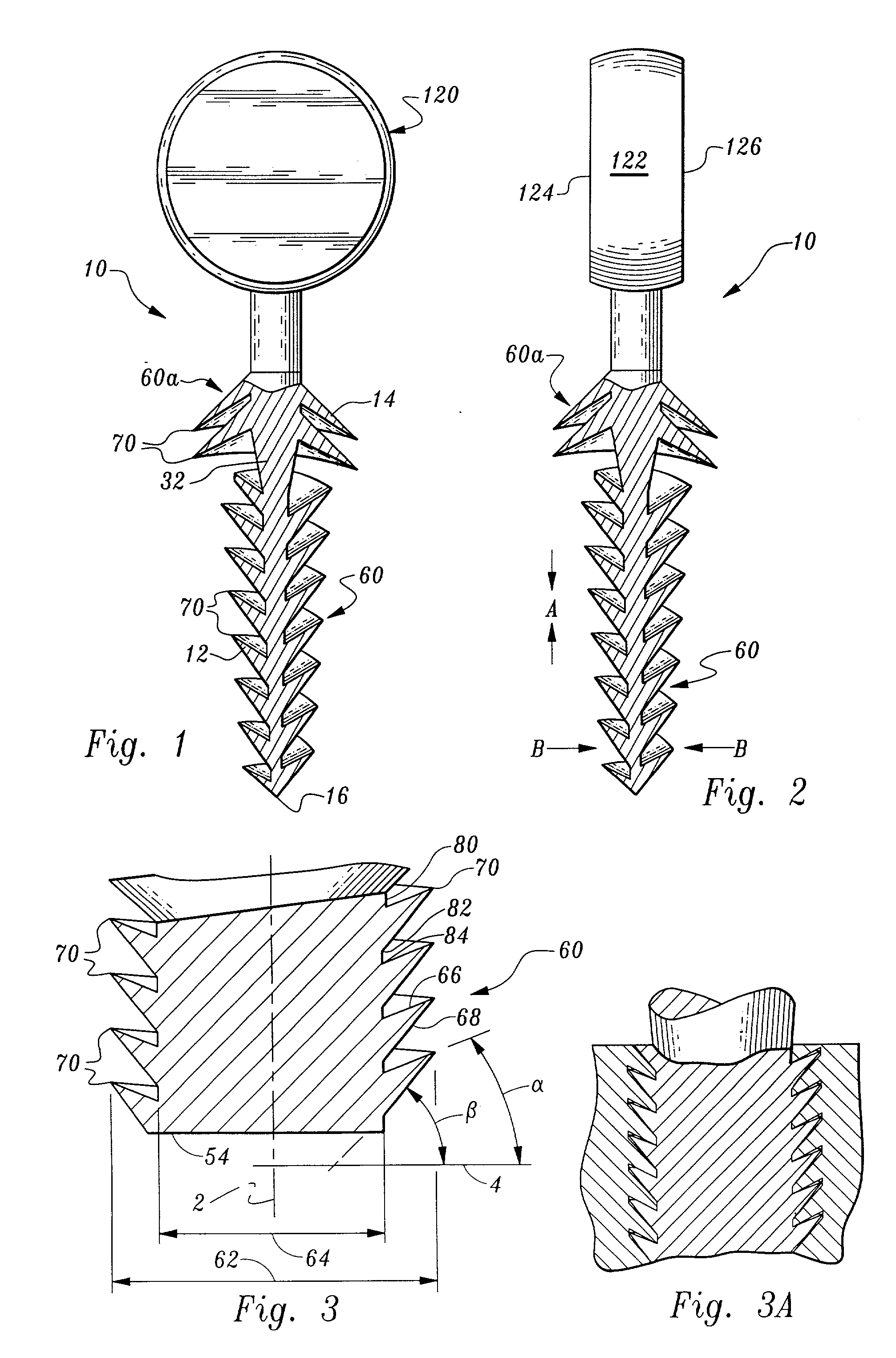 Orthopedic stabilization device and method