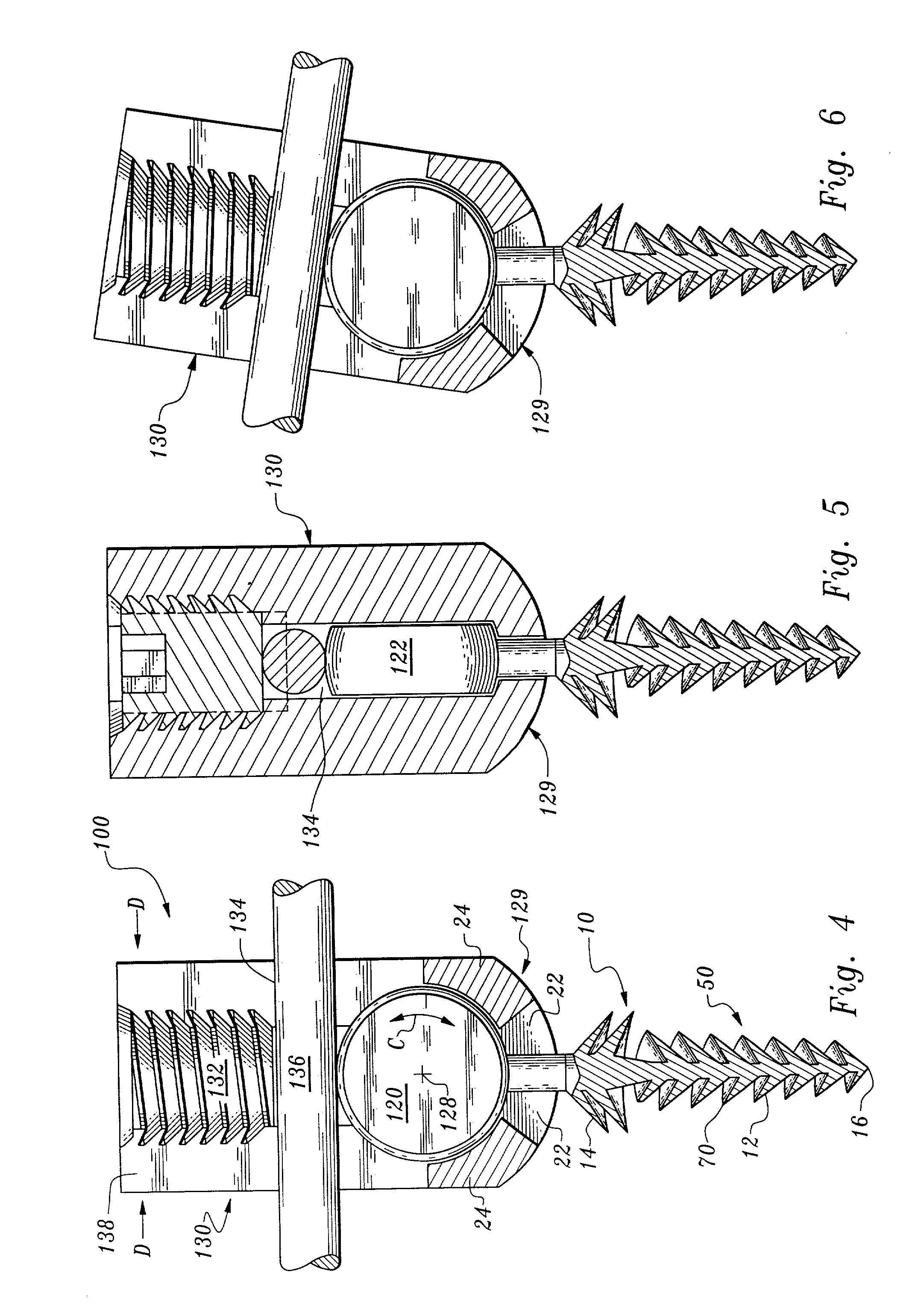 Orthopedic stabilization device and method