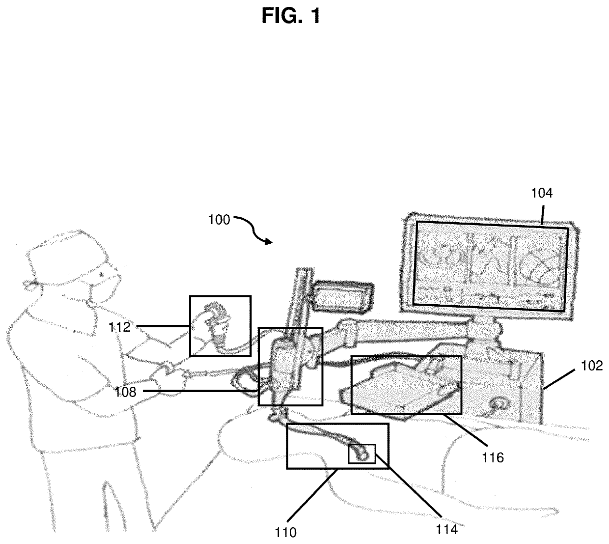 Real-time correction of regional tissue deformation during endoscopy procedure