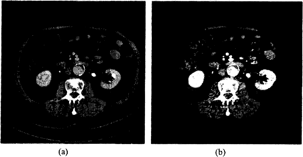 System and method for multi-image based virtual non-contrast image enhancement for dual source CT