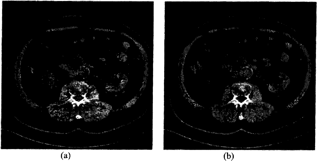 System and method for multi-image based virtual non-contrast image enhancement for dual source CT