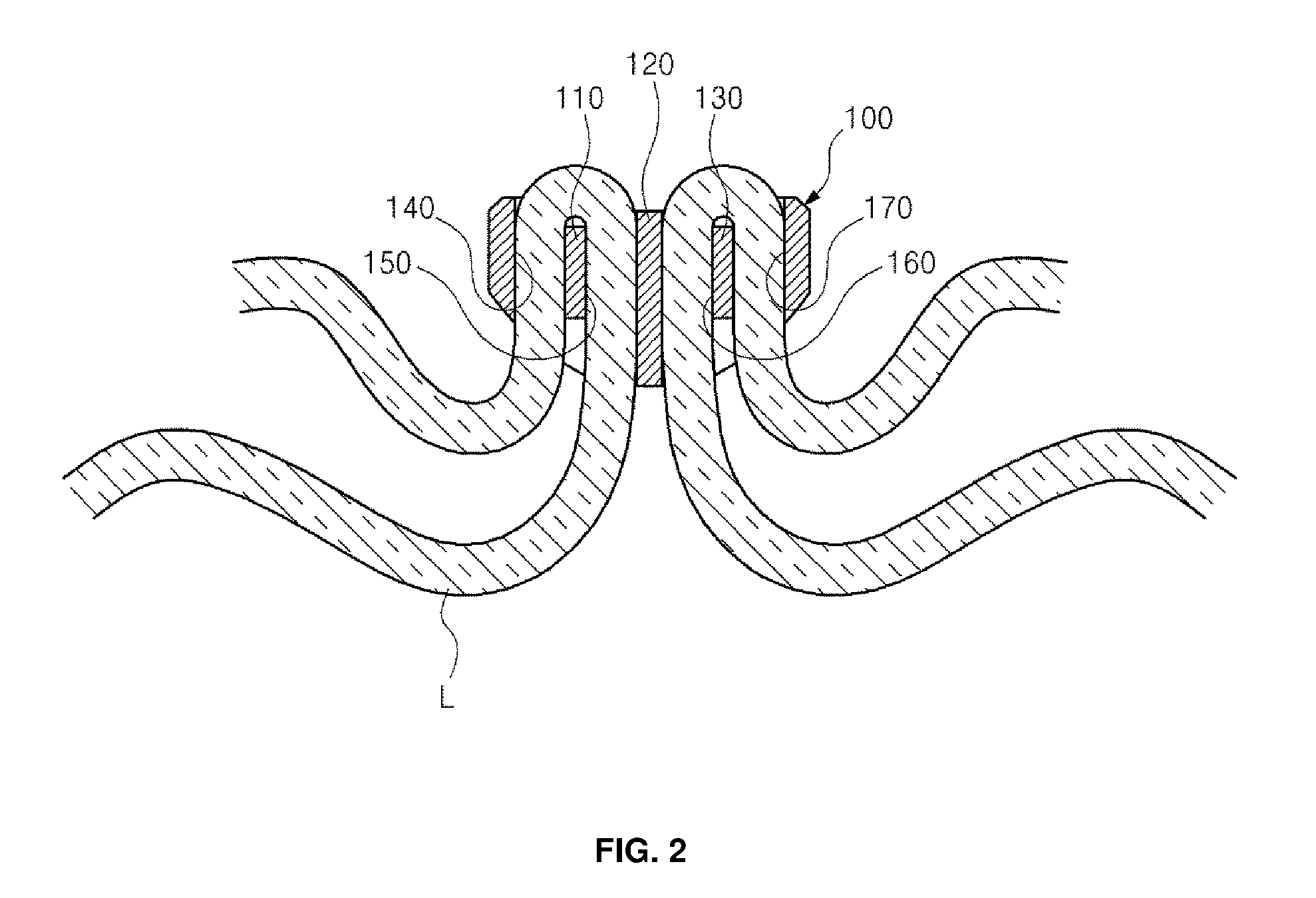 Shoelace binding device