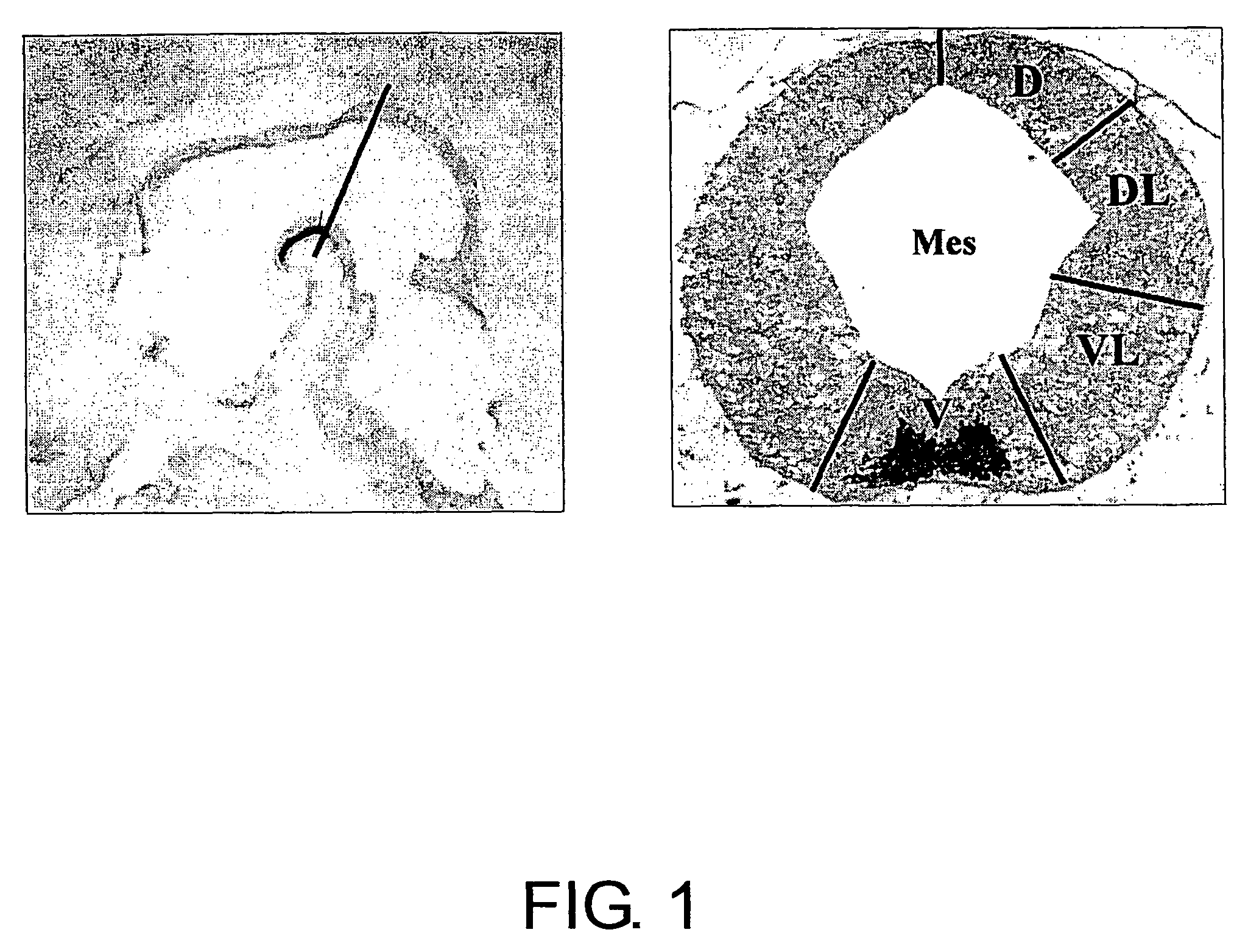 Specific marker Lmx1a on dopaminergic neurons