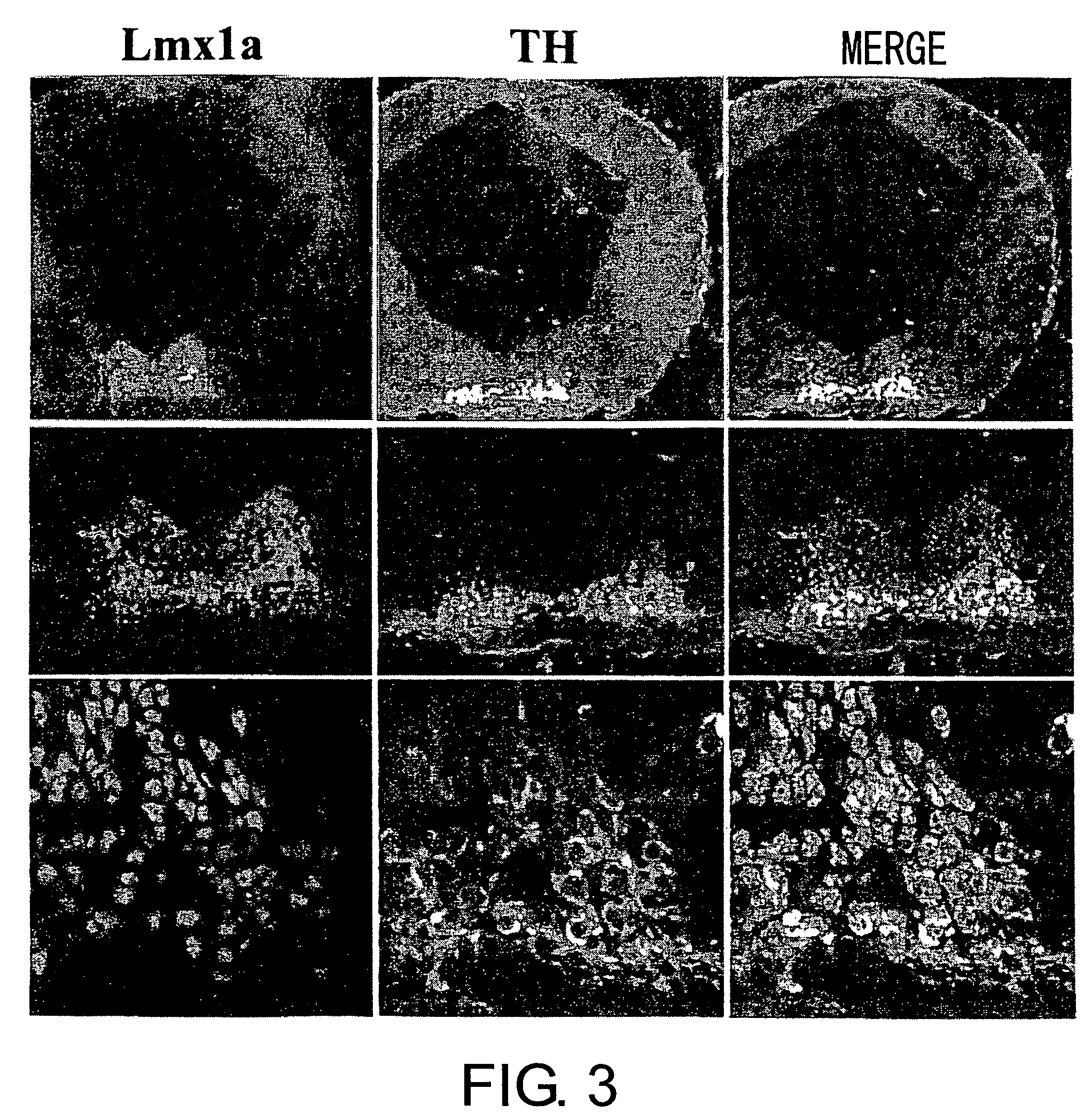 Specific marker Lmx1a on dopaminergic neurons