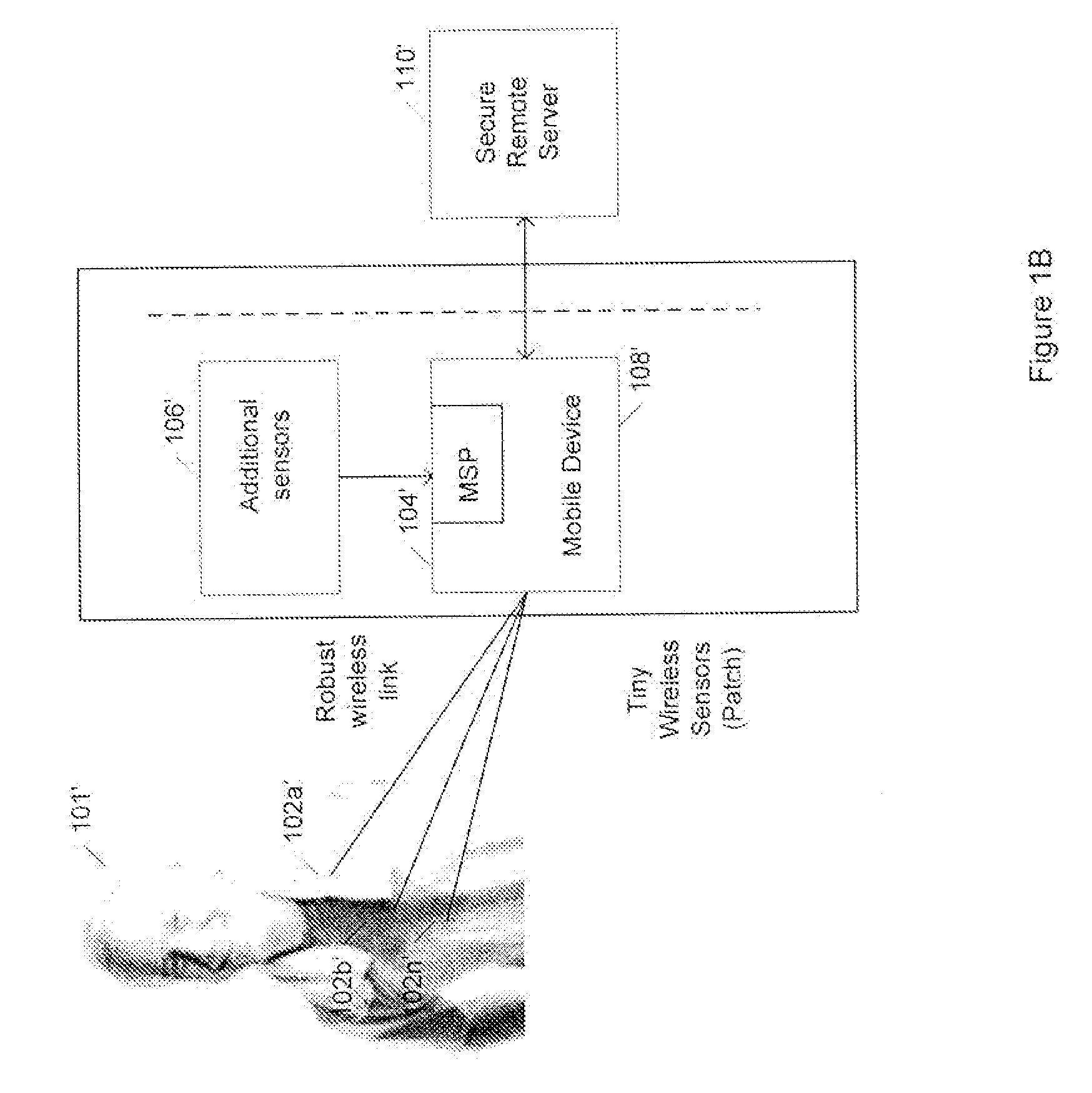 Medical signal processing system with distributed wireless sensors