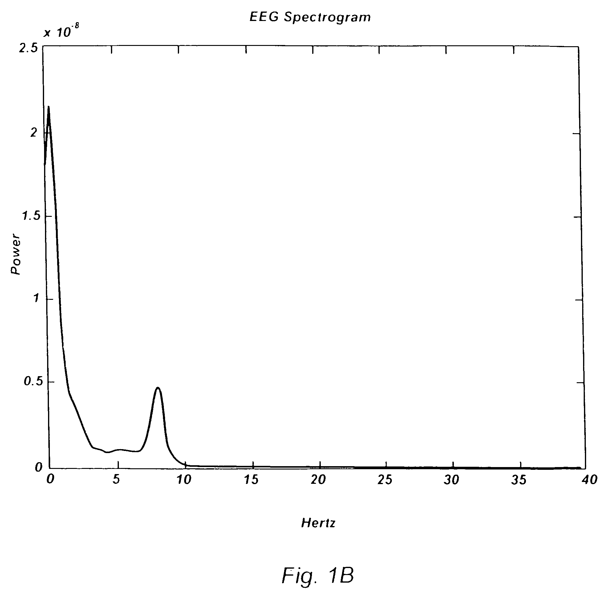 Method and system for analyzing and presenting an electroencephalogram (EEG)