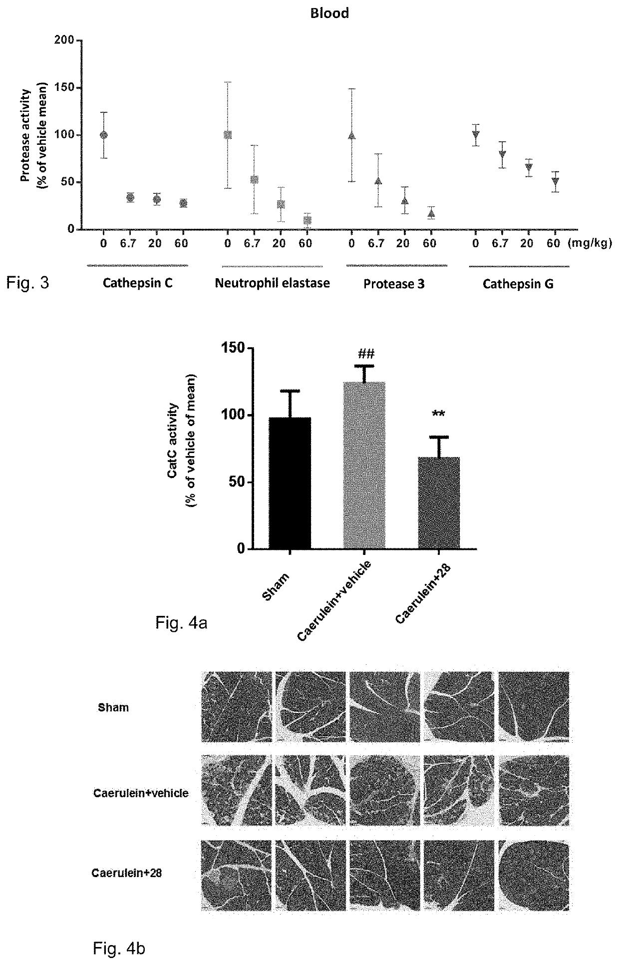 Cathepsin C inhibitors