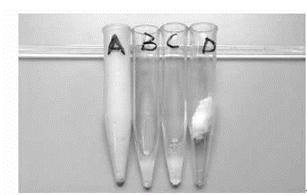 Nano-silver chitosan gel foam preparation for treating vaginal bacterial inflammation, and preparation method thereof