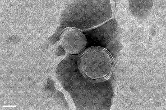 Targeted lipid-silica complex carrying doxorubicin and its preparation and application