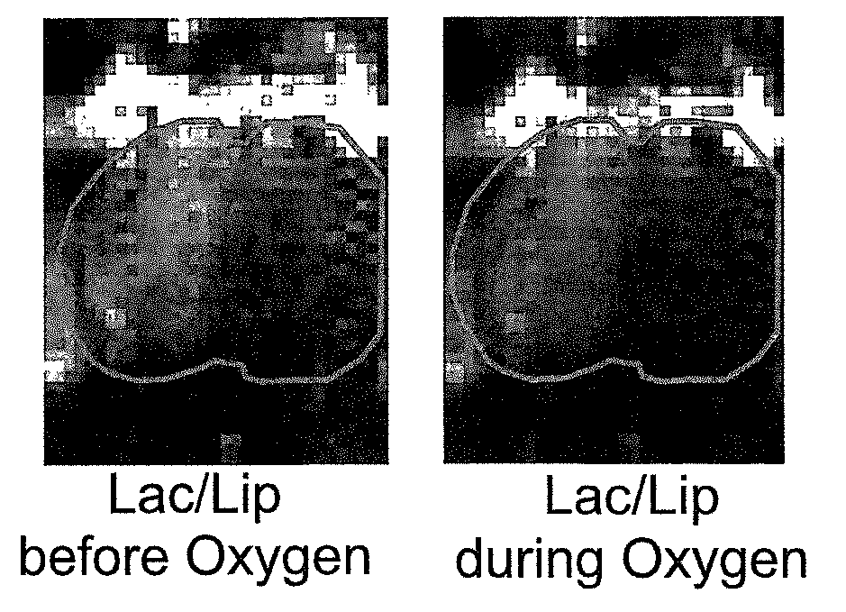 Method of determining metabolic function using magnetic resonance spectroscopic imaging