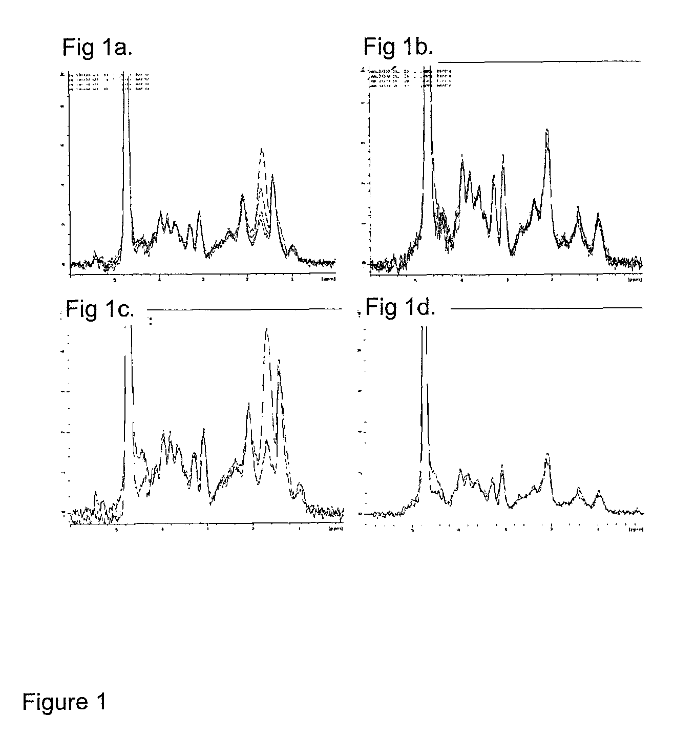 Method of determining metabolic function using magnetic resonance spectroscopic imaging