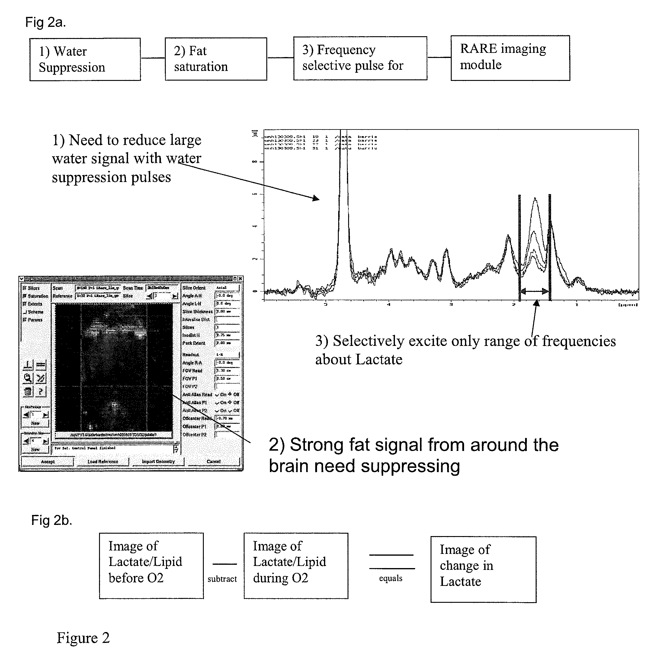 Method of determining metabolic function using magnetic resonance spectroscopic imaging