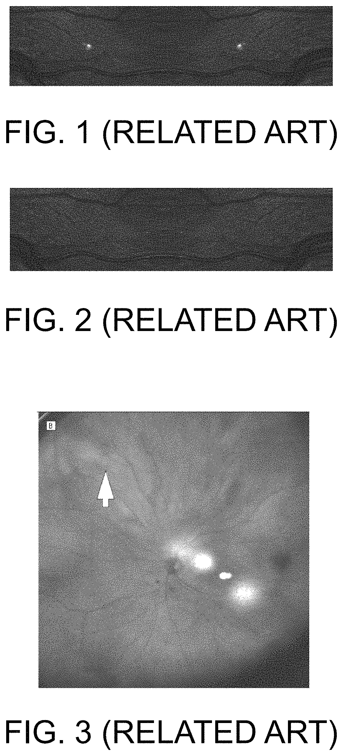 Confocal scanning laser ophthalmoscope