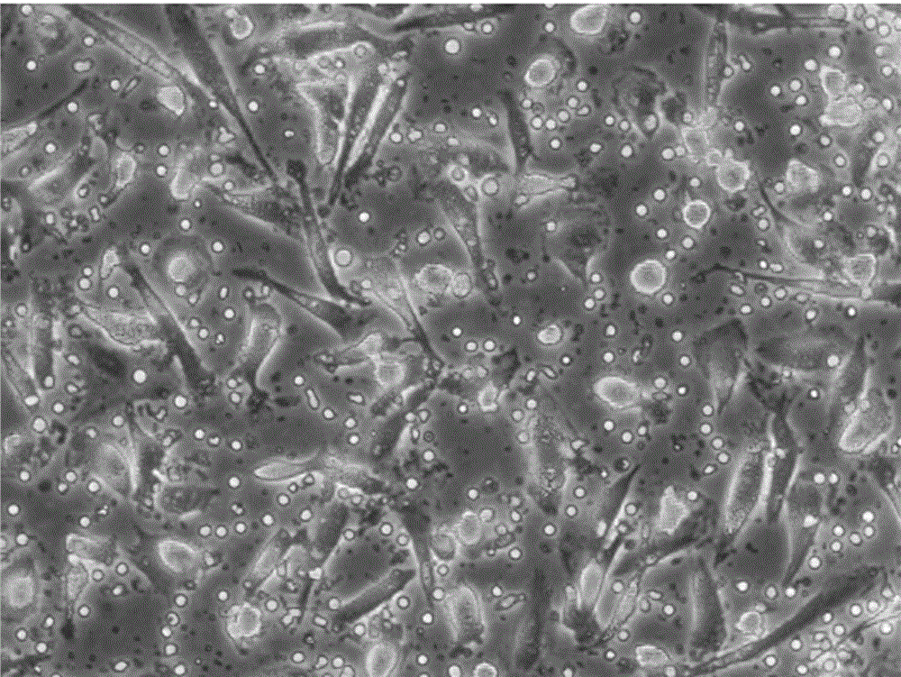 Human umbilical cord blood immune cell bank establishing method