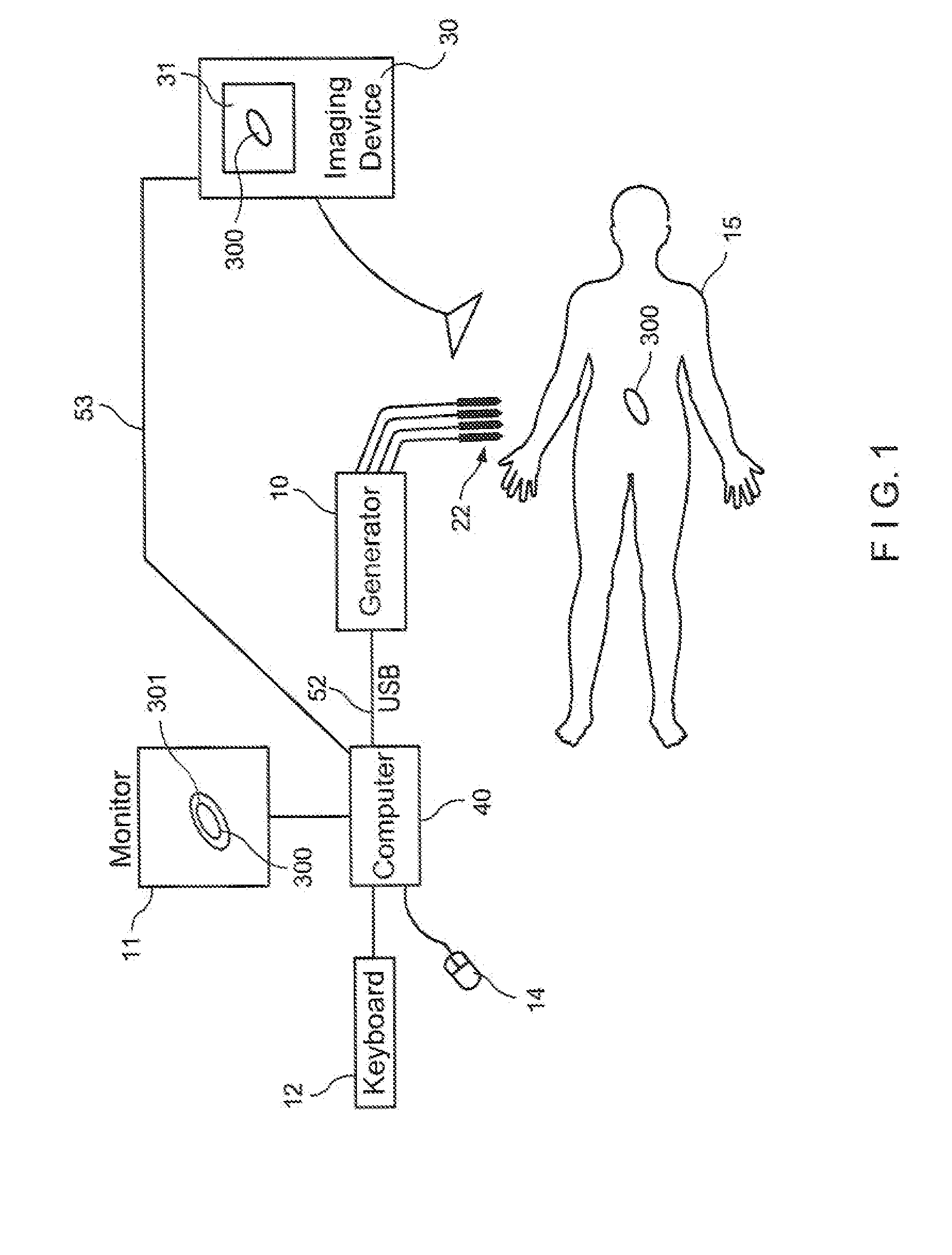 System and method for ablating a tissue site by electroporation with real-time pulse monitoring