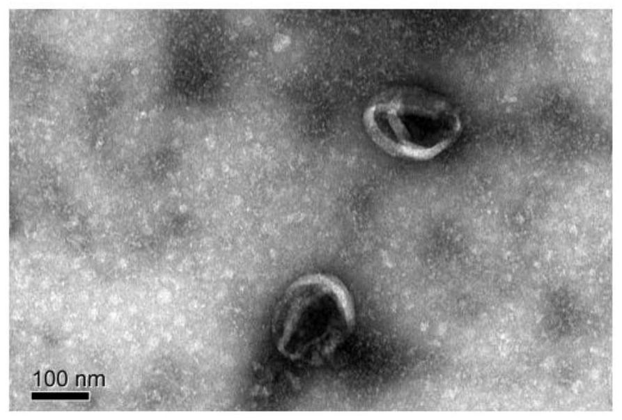 Cell vesicle for expressing chimeric antigen receptor as well as preparation method and application thereof