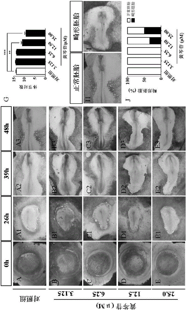 Application of baicalin in preparation of medicine for protecting heart development of fetus with pregnancy associated with diabetes