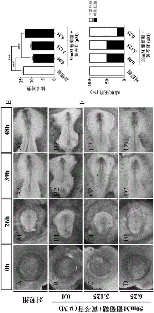 Application of baicalin in preparation of medicine for protecting heart development of fetus with pregnancy associated with diabetes