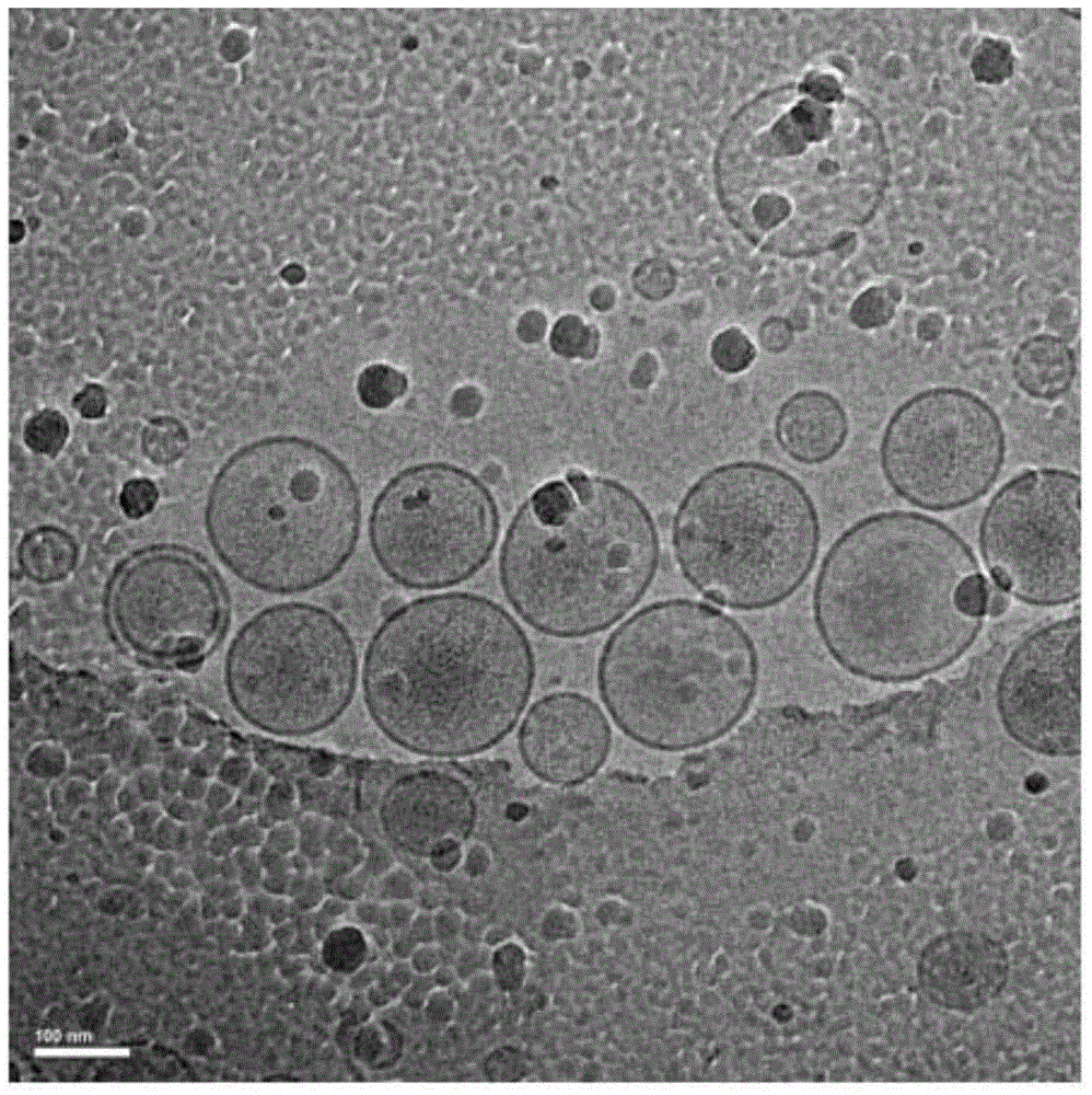 Irinotecan hydrochloride liposome pharmaceutical composition and preparation method thereof