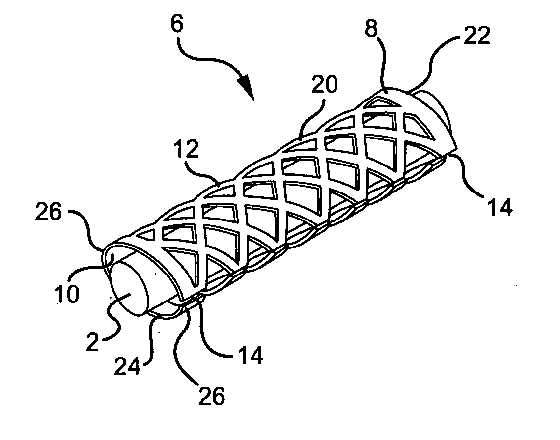 Device for treating carpal tunnel syndrome