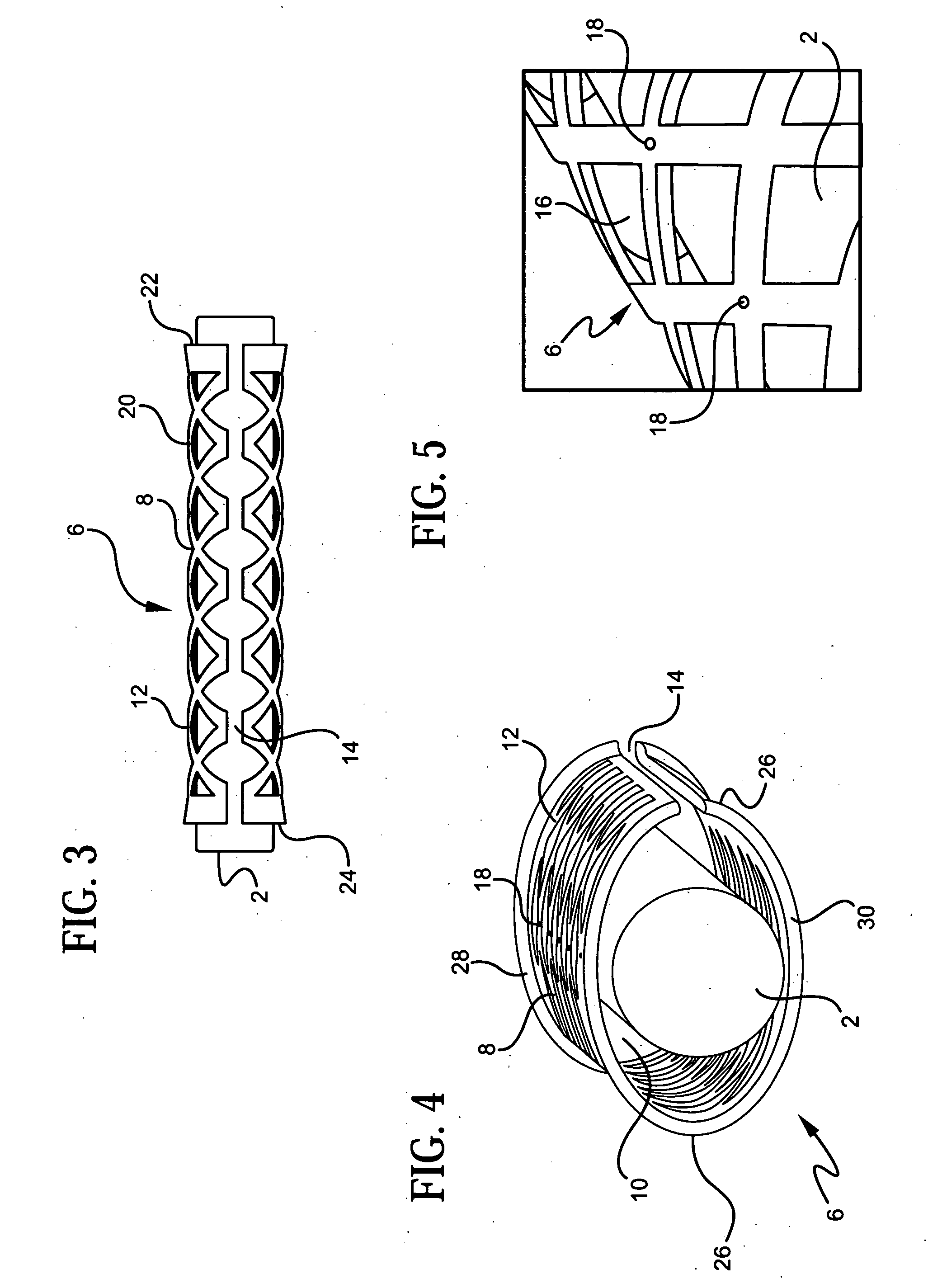 Device for treating carpal tunnel syndrome