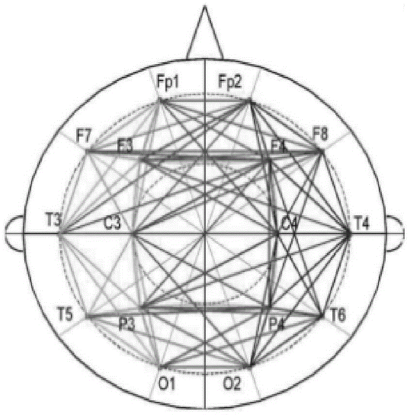 Alzheimer's disease detecting system and method based on electroencephalogram signals