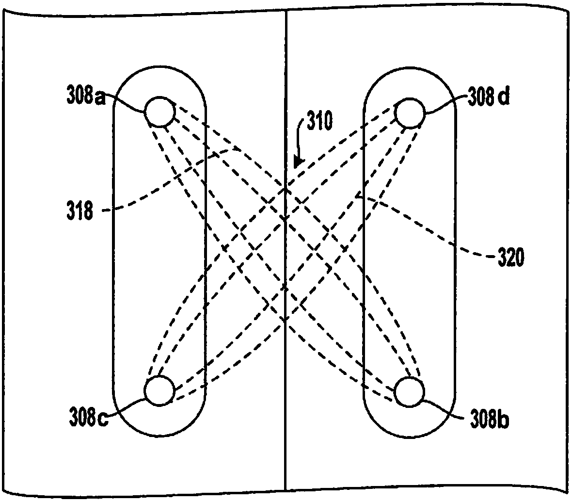 Spinal cord stimulation wih interferential current