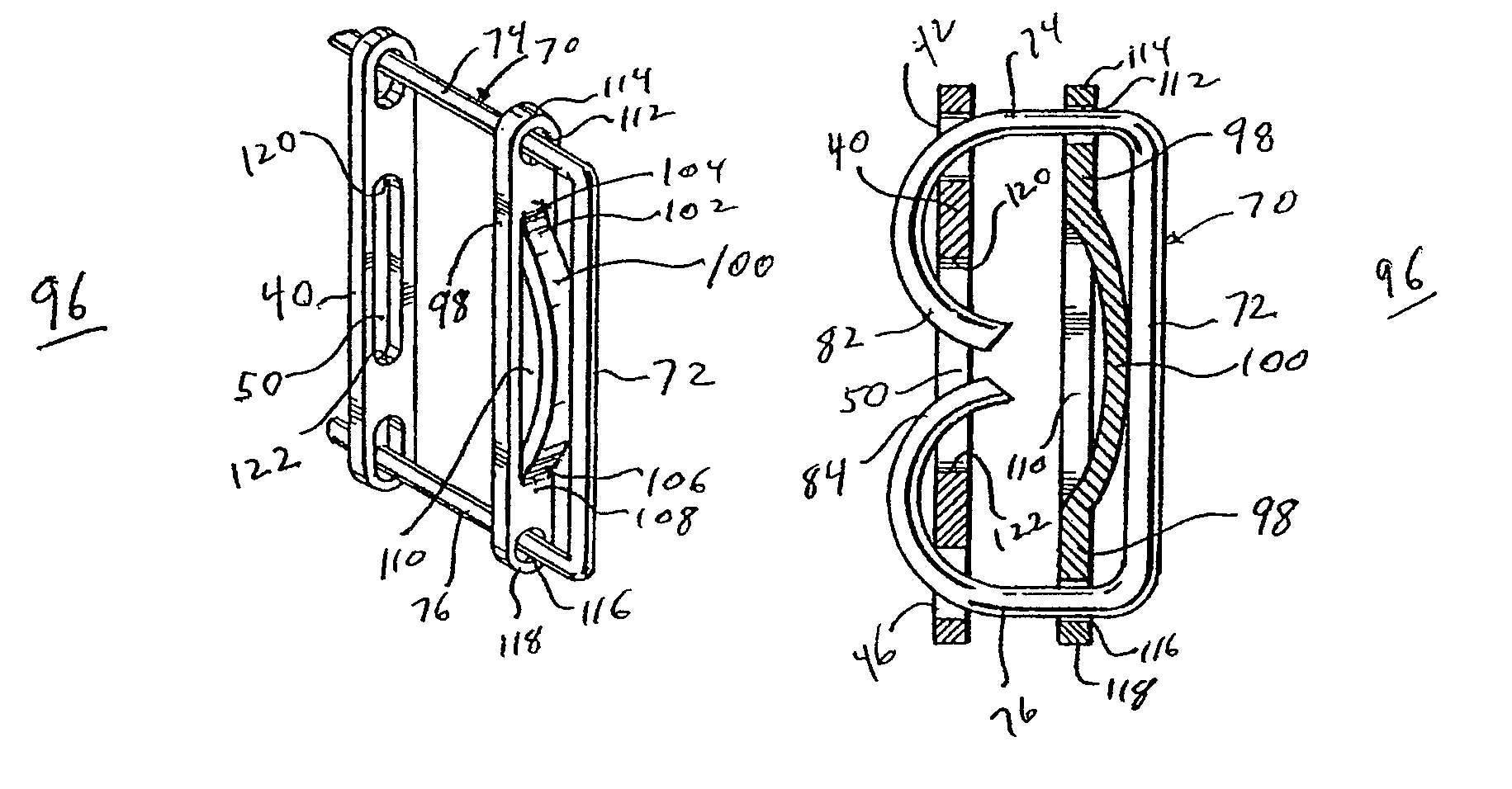 Surgical staple with augmented compression area