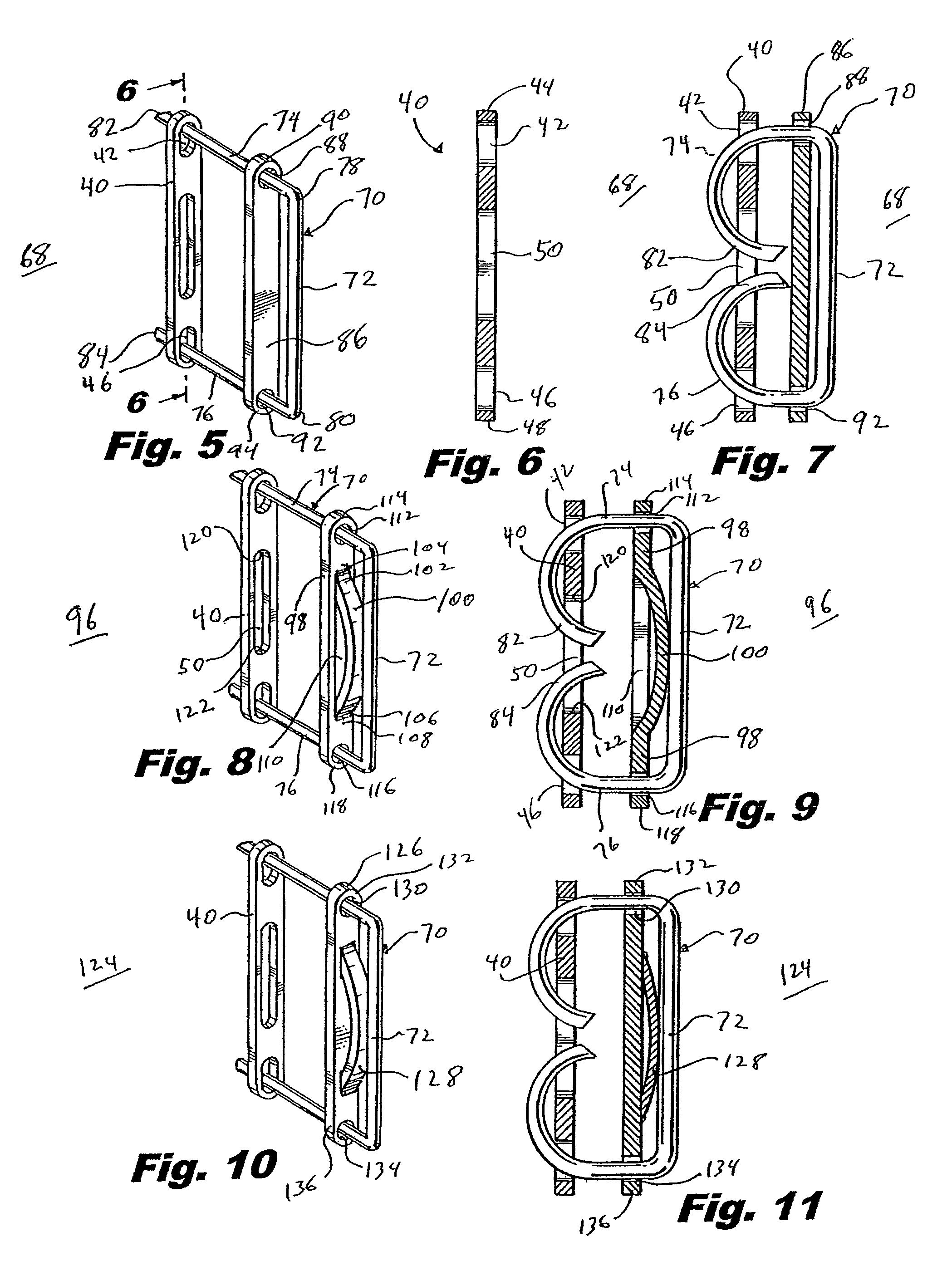 Surgical staple with augmented compression area