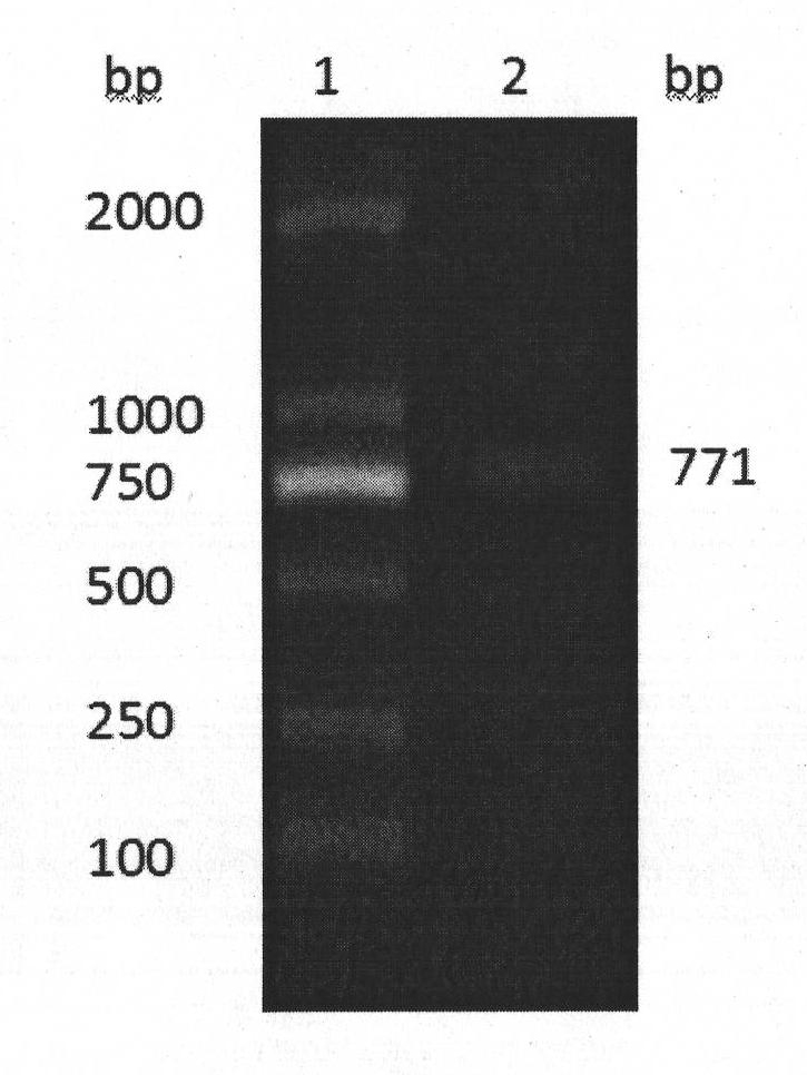 Human adiponectin ELISA kit