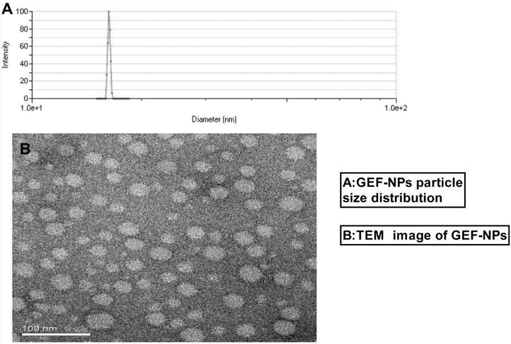 Nano-drug sustained release preparation for treating malignant tumor and preparation method thereof