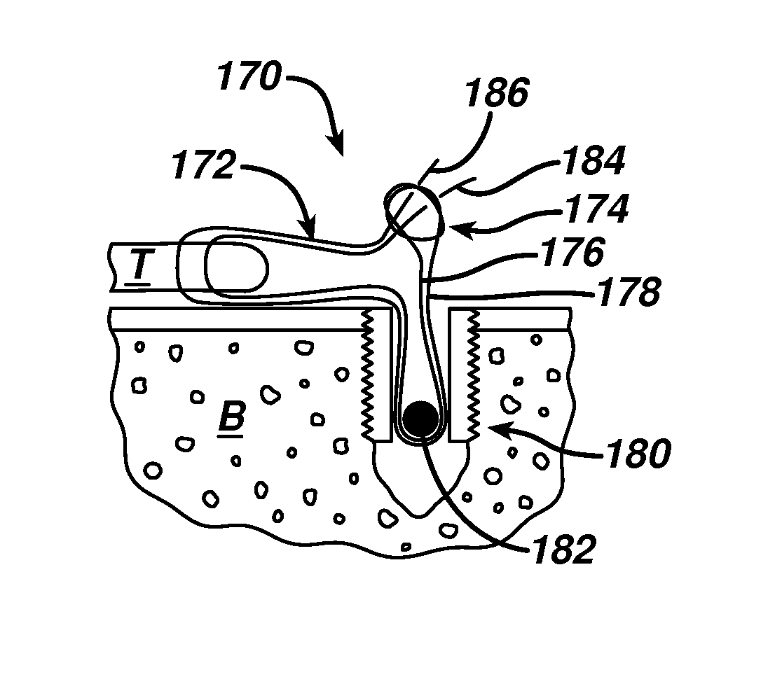 Surgical filament snare assemblies