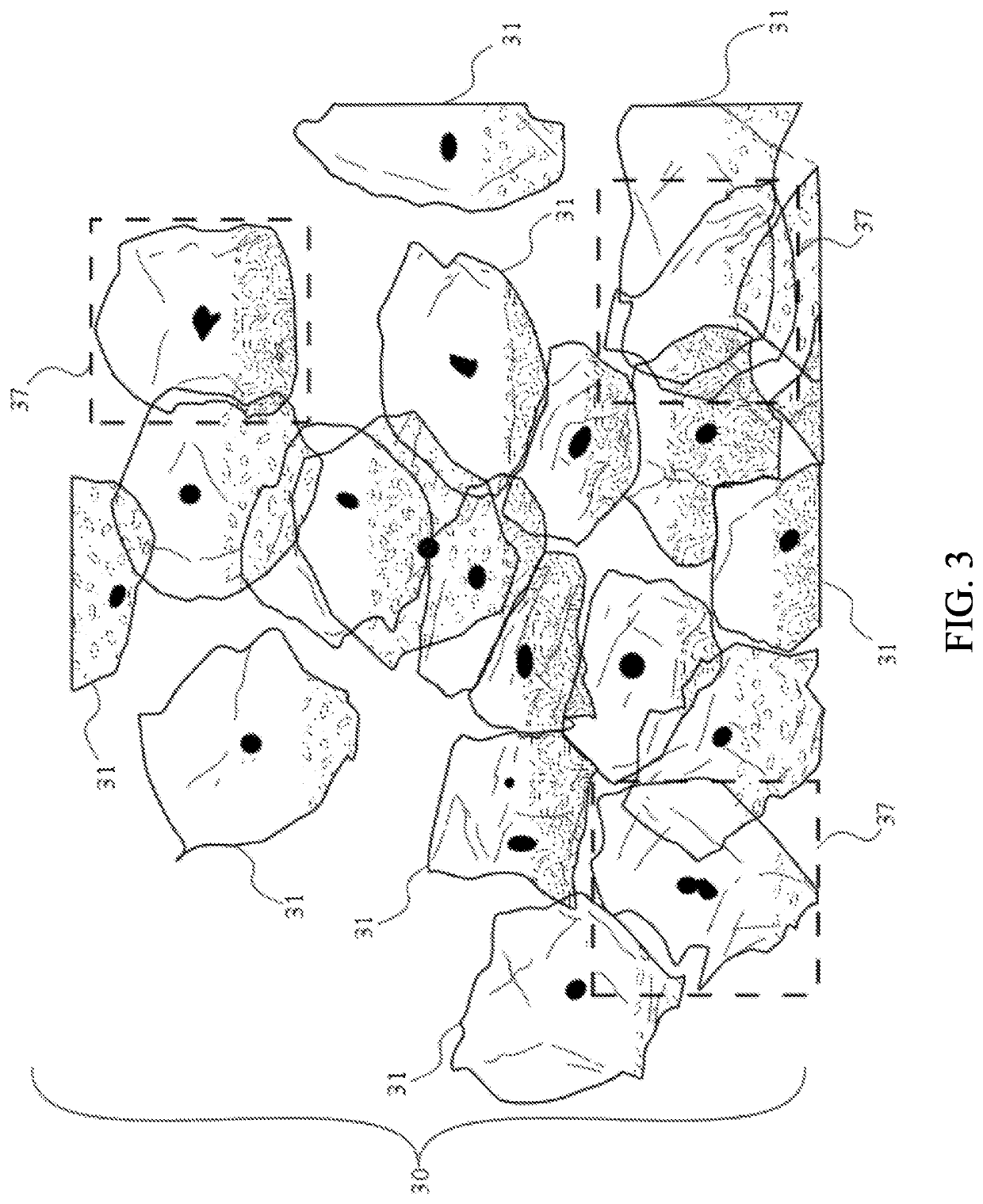 System and Method of Automatically Preparing and Analyzing Urine Samples for Identifying Cancer Cells